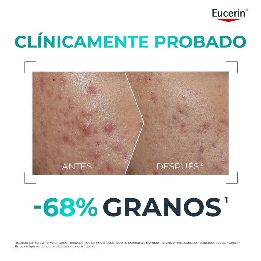 Eucerin Dermopure Clinical Probiom8 kit rutina probiótica – imagen 3