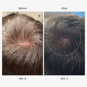 Olistic Hair Men | 28 Viales | Caída, Densidad y Crecimiento