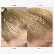 Olistic Women Next | 28 Viales | Cabello +45 años y Menopausia