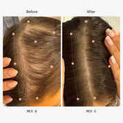 Olistic | Hair Nutraceutical Women 28 Viales