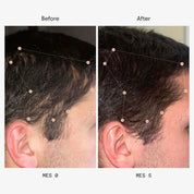 Olistic Hair Men | 28 Viales | Caída, Densidad y Crecimiento