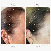 Olistic Women Next | 28 Viales | Cabello +45 años y Menopausia