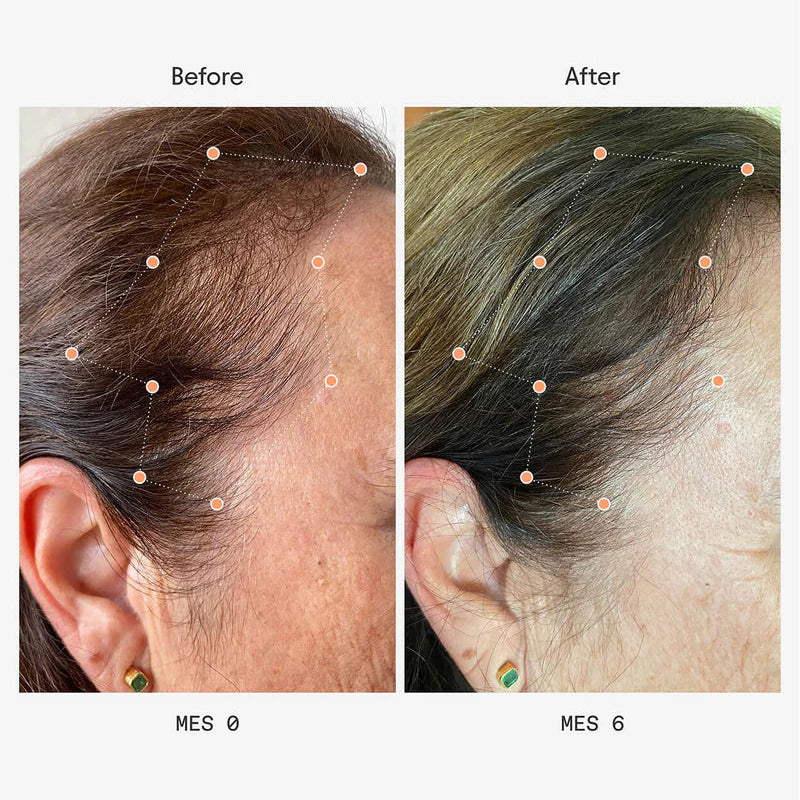 Olistic Women Next | 28 Viales | Cabello +45 años y Menopausia