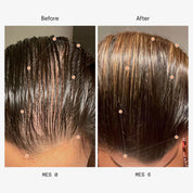 Olistic | Hair Nutraceutical Women 28 Viales