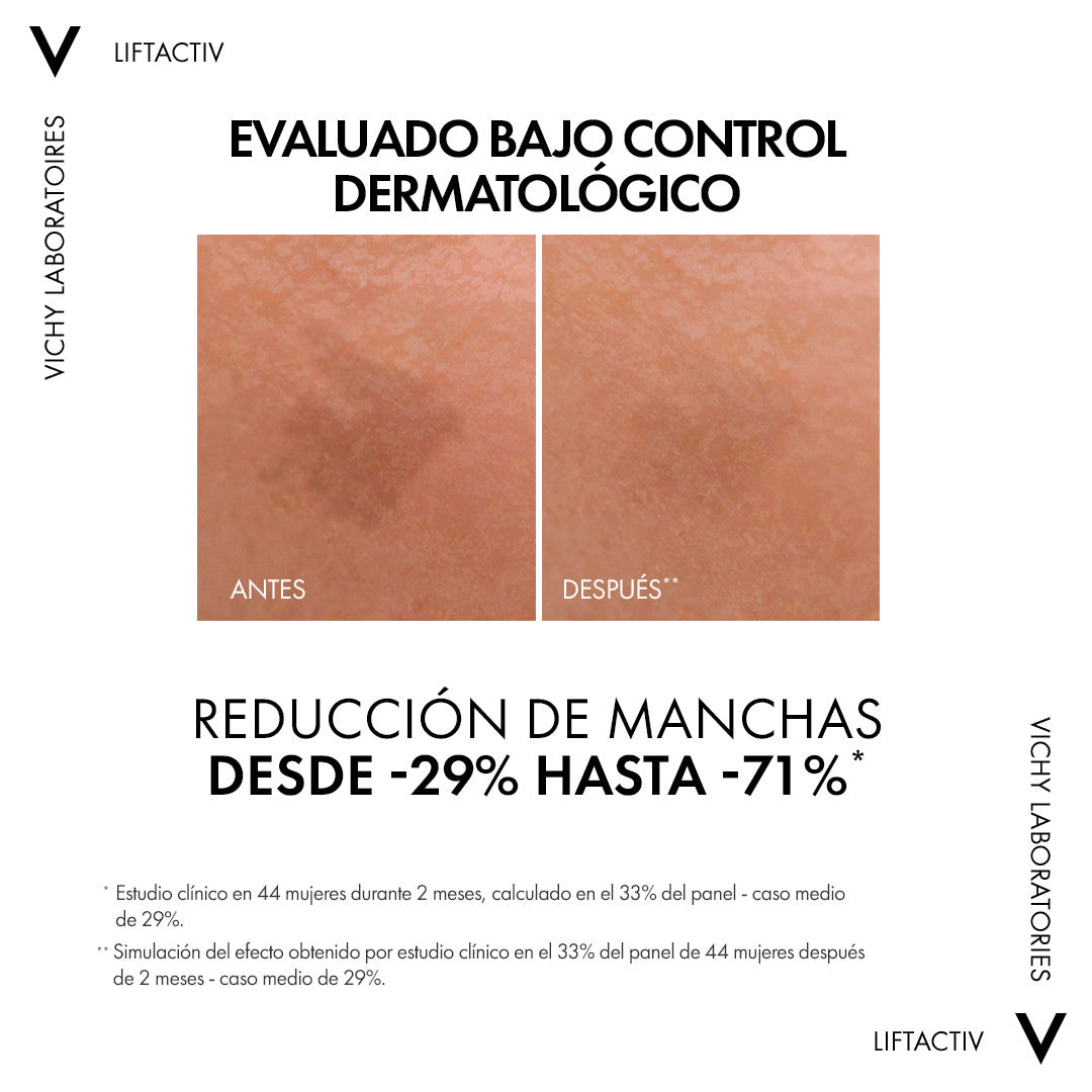 Vichy – Liftactiv B3 Sérum Antimanchas con Niacinamida