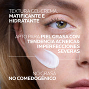 La Roche-Posay - Effaclar Duo (+M) Tratamiento Anti Imperfecciones Piel Grasa