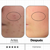 Advanced Nutrition Programme – Skin Clear Biome Imperfecciones