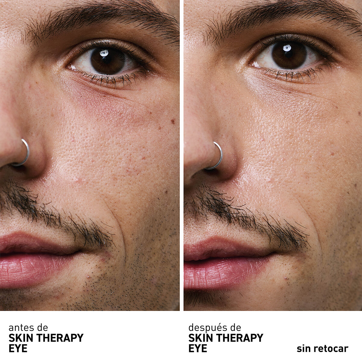 Erborian - Skin Therapy Eye Crema de Ojos