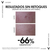 Vichy – Capital Soleil UV Clear SPF 50 Antiimperfecciones