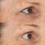 Perricone MD – Essential Fx Acyl-Glutathione Eyelid Lift Sérum Párpados