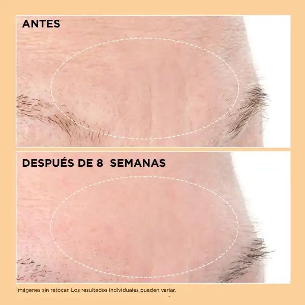 Perricone MD - Neuropeptide Deep Crease Serum