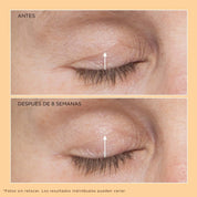 Perricone MD - Neuropeptide Eyelid Lift Serum