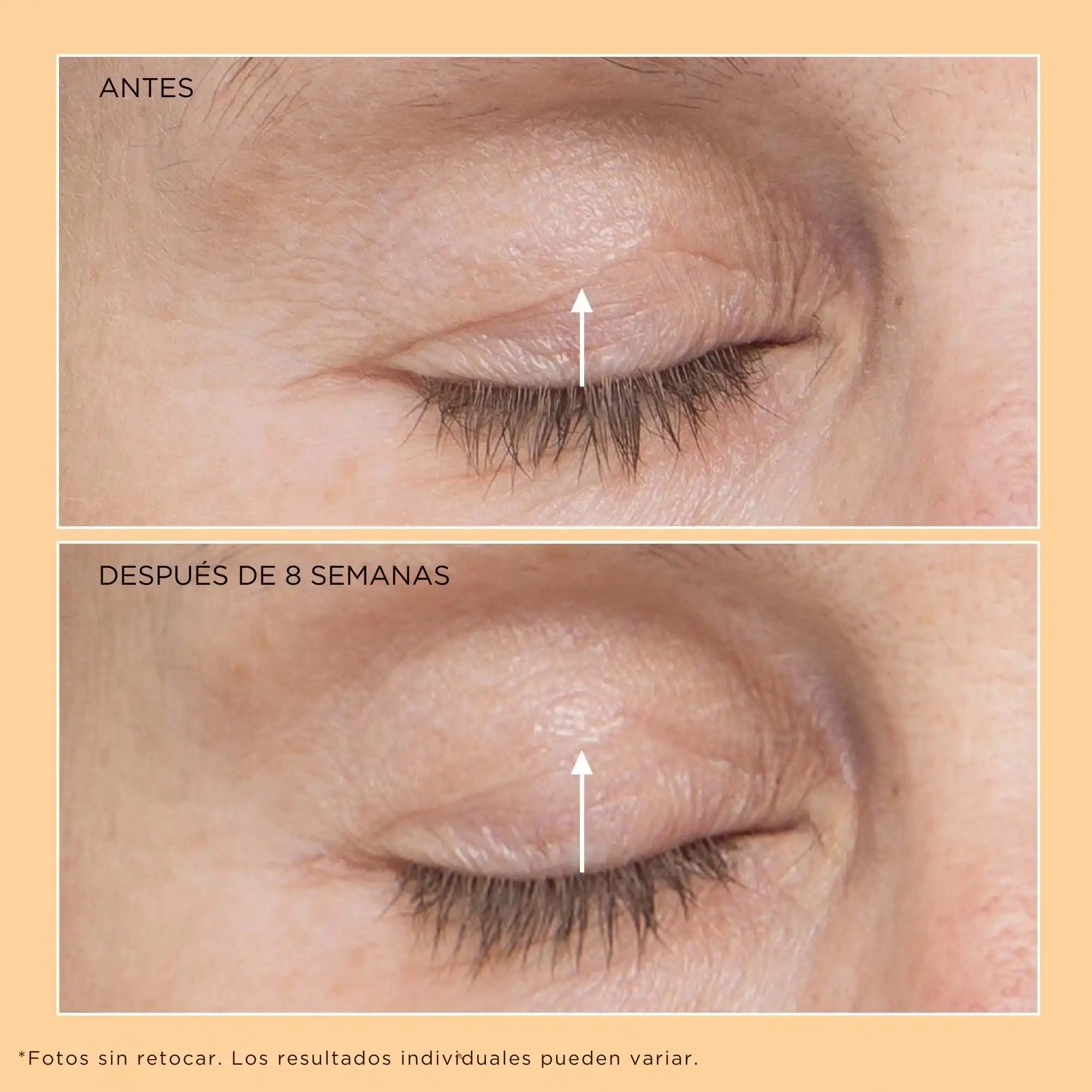 Perricone MD - Neuropeptide Eyelid Lift Serum