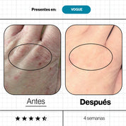 Advanced Nutrition Programme – Skin Omegas Nutrición Piel