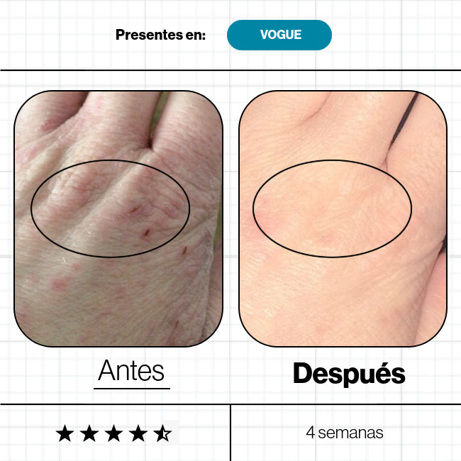 Advanced Nutrition Programme – Skin Omegas Nutrición Piel