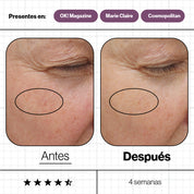 Advanced Nutrition Programme – Skin Ultimate 28 Días Antiedad Intensivo