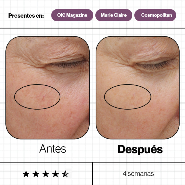 Advanced Nutrition Programme – Skin Ultimate 28 Días Antiedad Intensivo