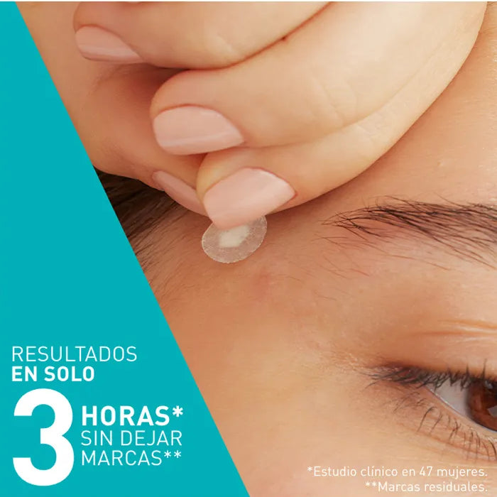 blemish-patches-2-LG.webp