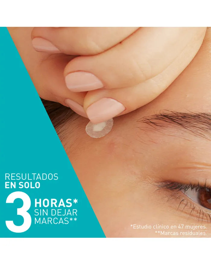 CeraVe – Parches Control Imperfecciones Anti-Acné 22 Unidades