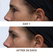 Perricone MD – Cold Plasma Plus+ Eye Contorno de Ojos Antiedad