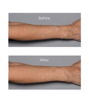 Perricone MD – Cold Plasma Plus+ Fragile Skin Therapy Tratamiento Piel Sensible y Fragilizada
