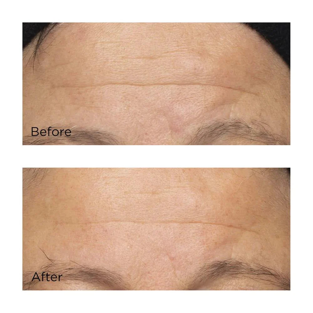 Perricone MD – Cold Plasma Plus+ Intensive Hydrating Complex Crema Hidratación Intensiva
