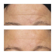 Perricone MD – Cold Plasma Plus+ Intensive Hydrating Complex Crema Hidratación Intensiva