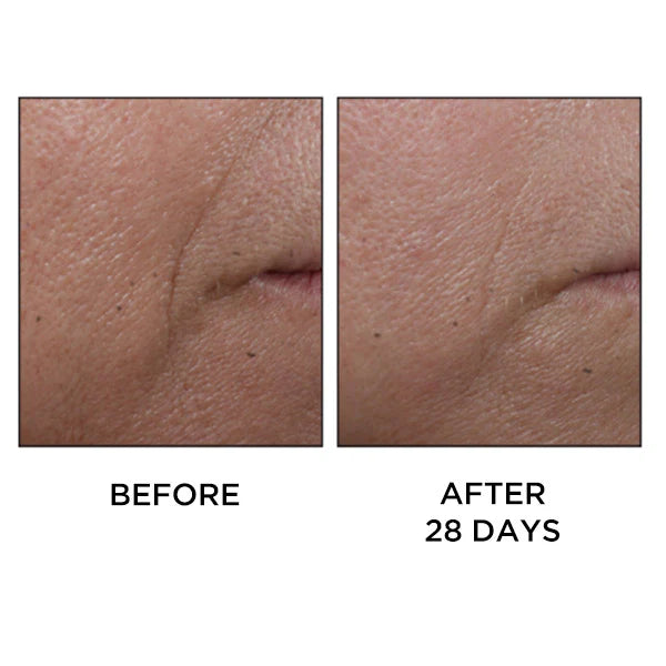 Perricone MD – Cold Plasma Plus+ Face Crema Tratamiento Global Antiedad