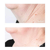 Perricone MD – Cold Plasma Plus+ Sub-D Neck Tratamiento Reafirmante Cuello y Papada